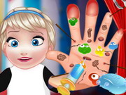 Baby Elsa Hand Doctor