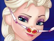 Elsa Nose Problems