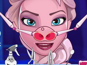 Frozen Nose Problems