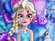 Injured Elsa Frozen