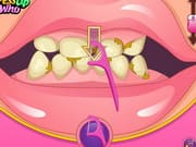 Bad Teeth Makeover